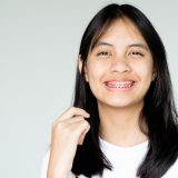 Orthodontic braces in Singapore