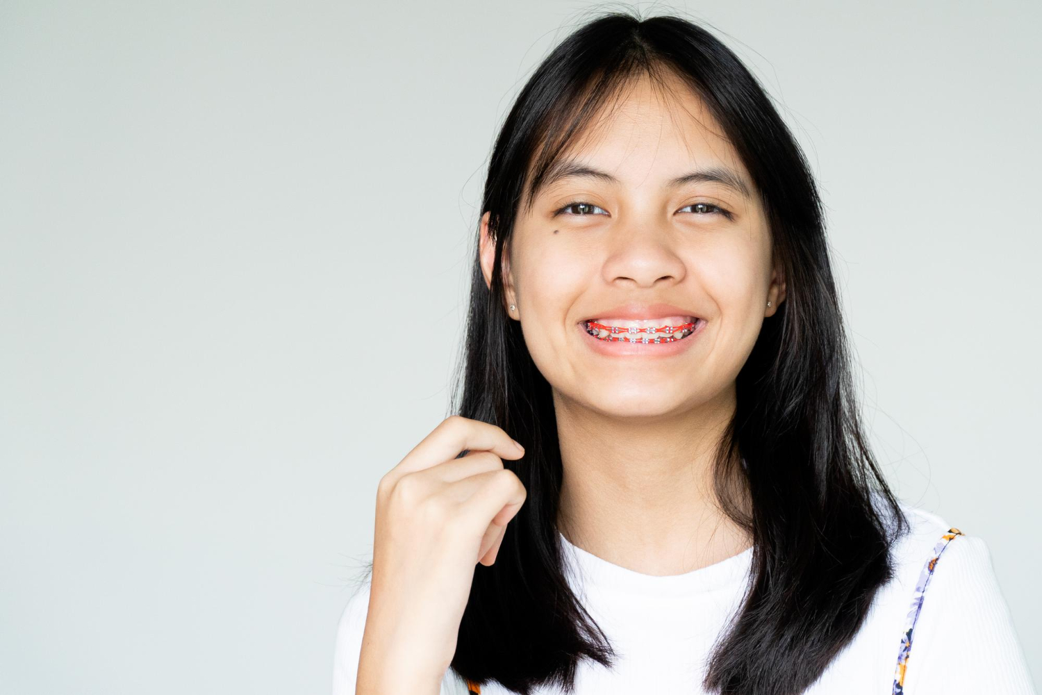 Orthodontic braces in Singapore