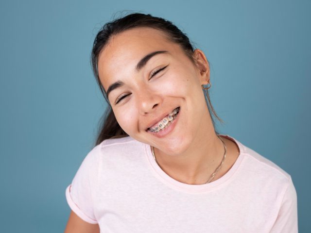 Braces faqs