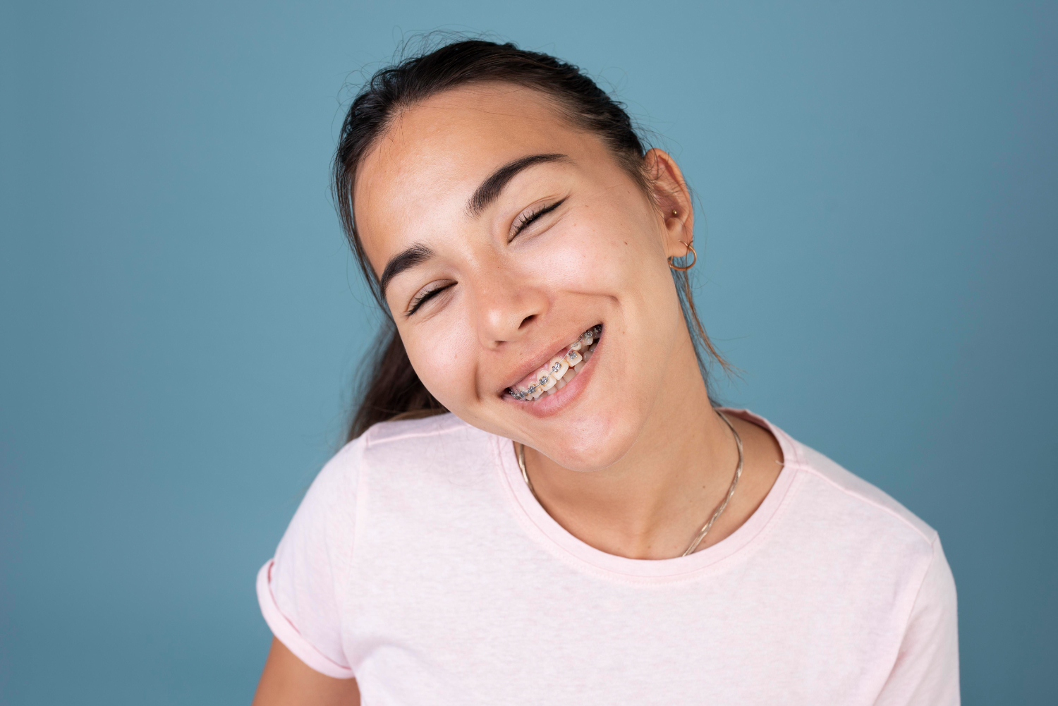 Braces faqs