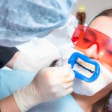 in-clinic teeth whitening